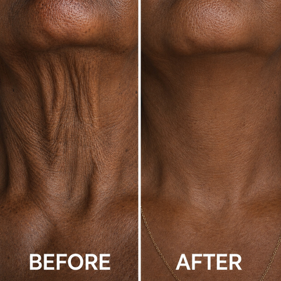 Collagen Neck Wrinkle Cream