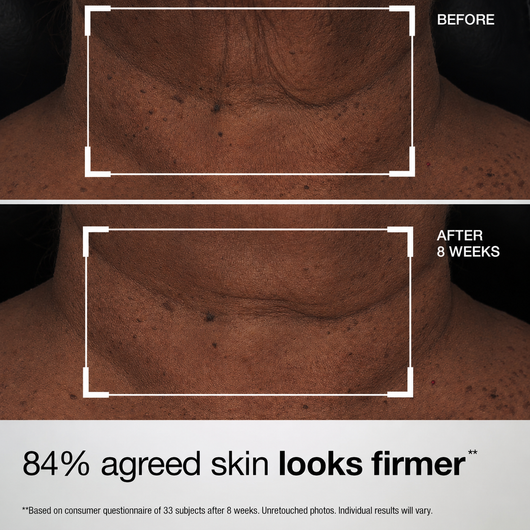 Collagen Neck Wrinkle Cream
