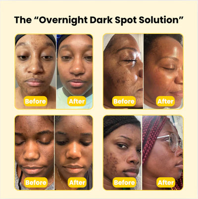 Kojic Acid Turmeric Overnight Mask