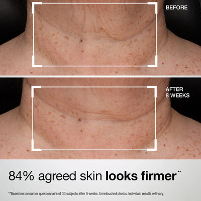 Collagen Neck Wrinkle Cream