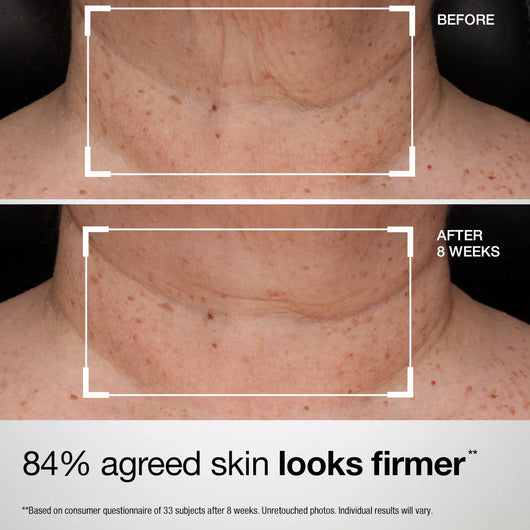 Collagen Neck Wrinkle Cream