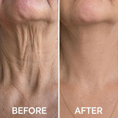 Collagen Neck Wrinkle Cream