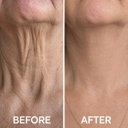 Collagen Neck Wrinkle Cream